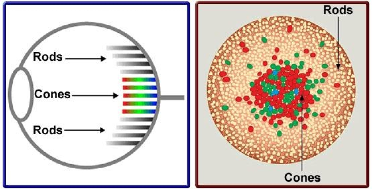 Colour Vision Deficiency or Colour Blindness - Eyescreen™